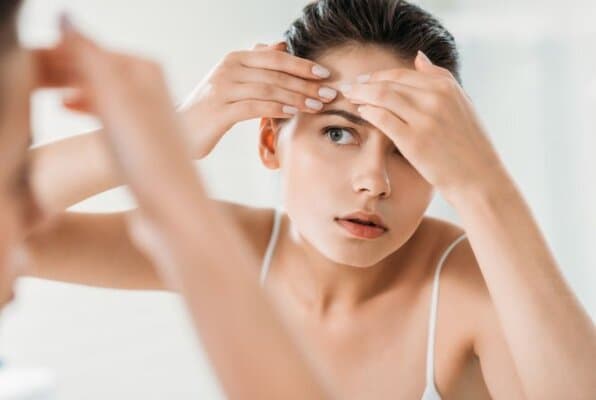 טיפול באקנה